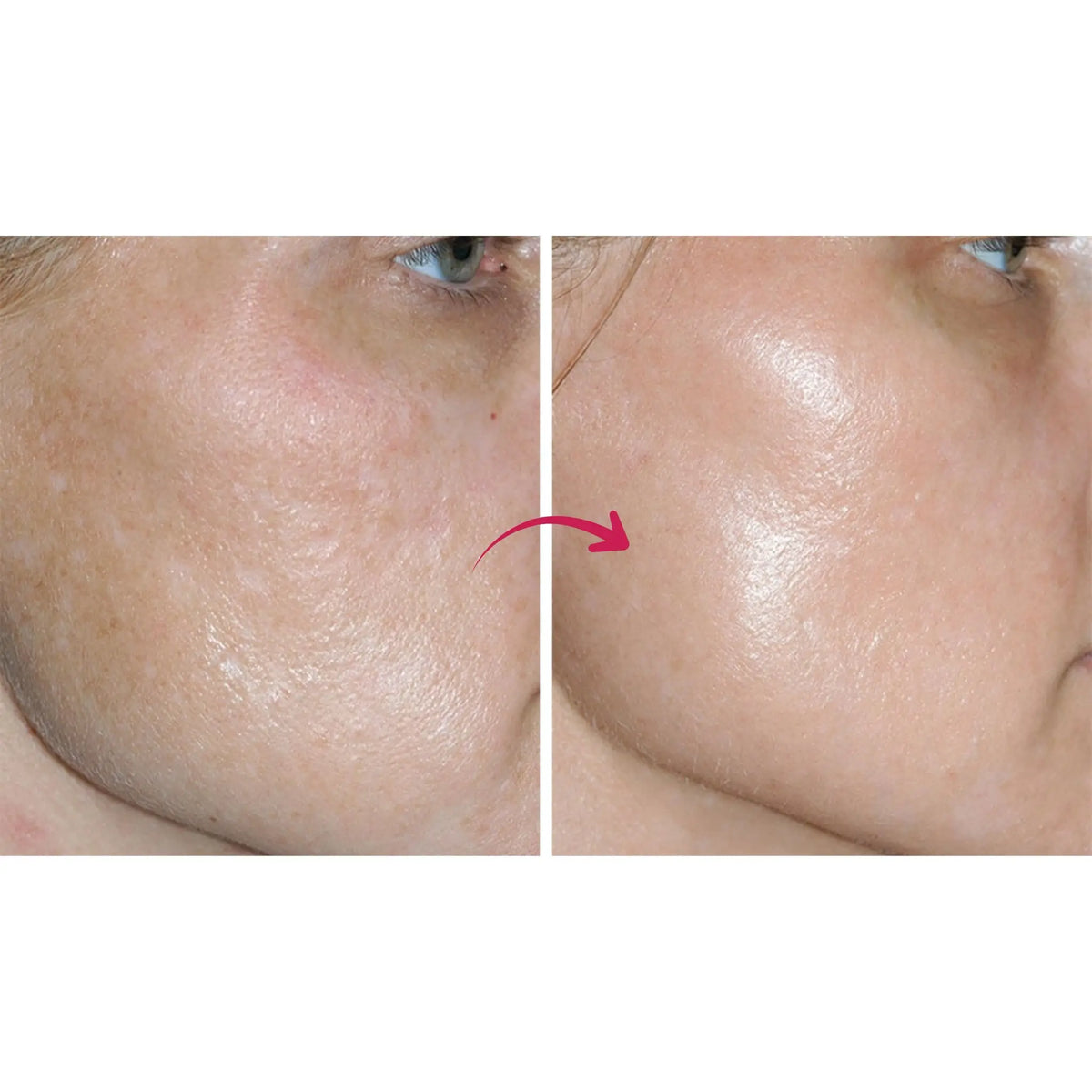 GLOWPOP BRIGHTENING CREAM