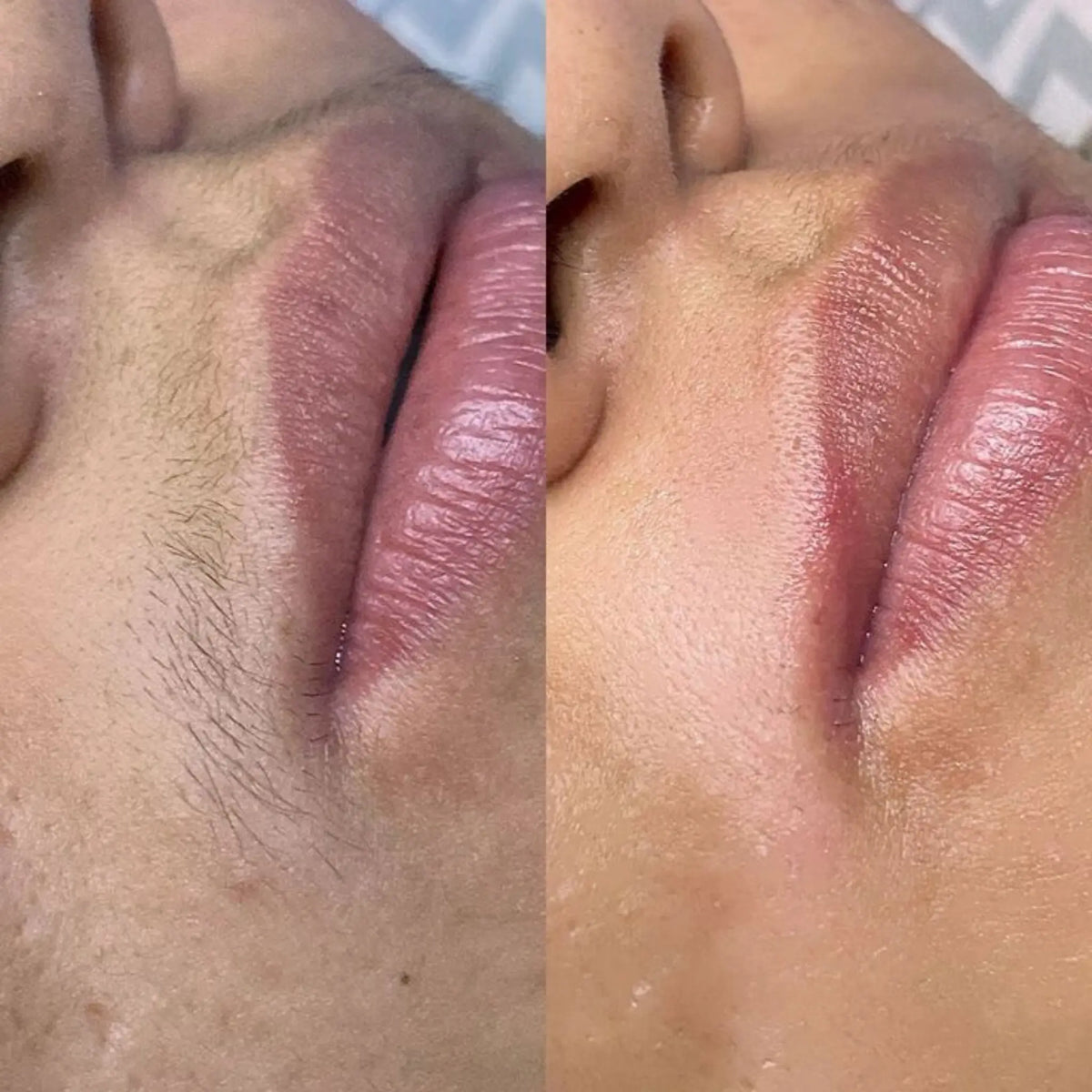 FUZZ-FADE HAIR GROWTH INHIBITOR